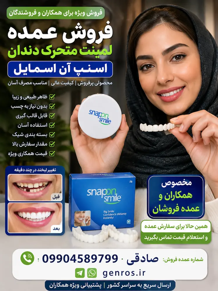 پخش عمده لمینت متحرک اسنپ ان اسمایل