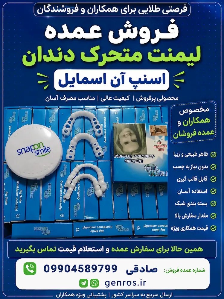 فروش عمده لمینت متحرک اسنپ آن اسمایل